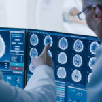 CRAs Must Evolve Alongside Oncology Therapeutics